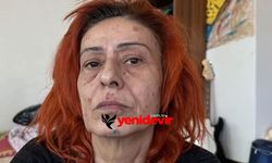 Yıldız Tilbe’nin yüzündeki izler endişelendirdi! Ne oldu?