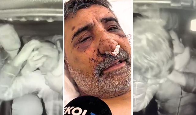 Taksici Biçer konuştu: Boynumu kırmaya çalıştı, gözlerime parmak soktu